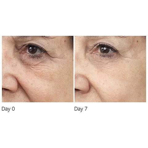before and after