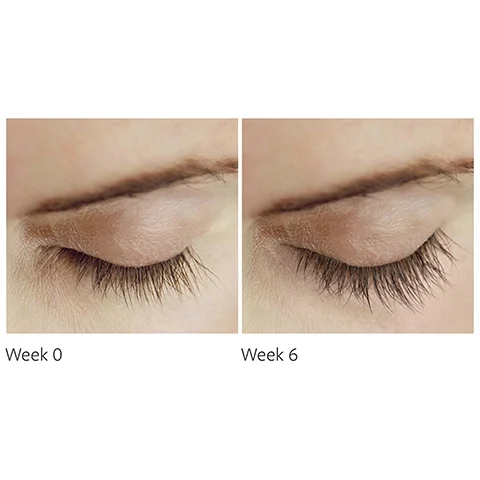 before and after