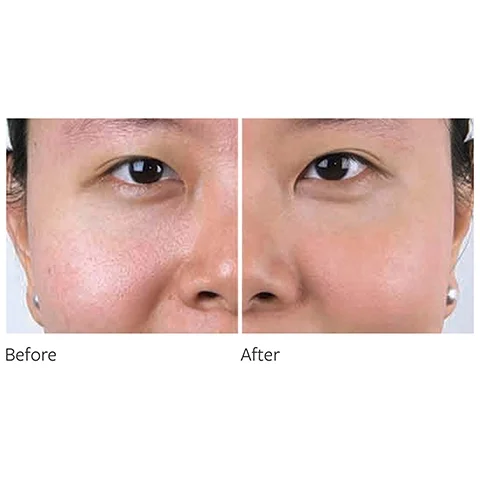 before and after