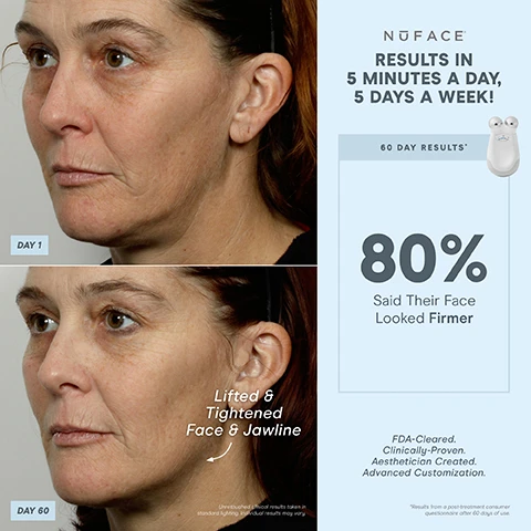 Image 1, results in 5 minutes a day, 5 days a week. day 1 vs day 60. lifted and tightens face and jawline. 60 day results. 80% said their face looked firmer. unretouched clinical results taken in standard lighting. individual results may vary. FDA cleared, clinically proven, aesthetician created. advanced customization. results from a post treatment consumer questionnaire after 60 days. image 2, 1 device, 3 attachments customised treatments. 5 intensity levels, effective lip and eye attachment - lifts and tightens hard to reach areas around the mouth and eyes. 5 second beep. auto shut off at 21 minutes. charging cradle. micro current technology perfect for customisation. image 3, targeted results. tighten skin around the eyes. lift the brow. lift the lips and smile lines. image 4, results in 5 minutes a day, 5 days a week. day 1 vs day 60 - smoother skin. unretouched clinical results taken in standard lighting individual results may vary. 60 day results, 80% saw smoother skin. FDA cleared, clinically proven, aesthetician created, advanced customisation. results from post treatment consumer questionnaire after 60 days of use. image 5, results 5 minutes a day, 5 days a week. day one vs day 60. unretouched clinical results taken in standard lighting, individual results may vary. 60 say results, 82% said their face looked more toned. 80% said their face looked firmer. 78% saw smoother skin. FDA cleared, clinically proven, aesthetician created, advanced customisation. image 6, lifted brows, contour cheeks, lift lips, contour jawlines, tighten neck. image 7, 1 device customisable results. instant results that build with consistent use contour = cheeks. lift = eyes and brows. tone = jowls and jawline. smooth = neck and forehead. lift = lips and smile lines. image 8, trinity = customised lifting. depth - to the muscle. intensity levels - 5. attachment options - eye an lip attachment and LED red light attachment sold separately - yes. micro current treatment areas - jowls and jawlines, neck, cheeks and forehead, around eyes and brows, around mouth and lips, smile lines. mini on the go-lifting = depth of treatment - to the muscle. intensity levels - 3. microcurrent treatment areas - jowls and jawline, neck and cheeks and forehead. fix instant finisher = depth of treatment - skin's surface. intensity levels - 1. microcurrent treatment areas - around eyes and brows, around mouth and lips, smile lines.