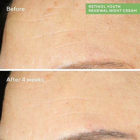 Image 1, before and after 4 weeks. retinol youth renewal night cream. image 2, 83% noticed firmer more supple skin. 80% saw increased radiance and glow. source the NPD group, prestiage beauty total measured market, retinol named skincare product layer sales, 12 months ending september 2020. image 3, retinol tri-active technology. a fast acting retinoid a time released booster help lines and deep wrinkles. niacinamide and picolinamide. how to use = PM. 1 = retinol youth renewal serum - at night apply a thin layer of serum to face, reduce frequency if sensitivity occurs. 2 = retinol youth renewal eye serum - morning and night gently pat eye serum around under eyes and lids, warming - avoid contact with eyes. retinol youth renewal night cream - at night massage cream evenly over face, neck and chest. always apply SPF in the morning.
