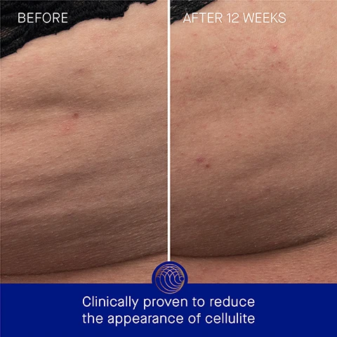 Image 3 - A split image showing a close-up of skin before and after treatment; the left side labeled Before shows more visible dimples and texture, while the right side labeled After 12 Weeks appears smoother, with less visible dimpling, along with the text Clinically proven to reduce the appearance of cellulite at the bottom.
Image 4 - Image shows a comparison of skin on the thigh with stretch marks, labeled BEFORE on the left side and AFTER 12 WEEKS on the right side, along with the text Clinically proven to reduce the appearance of stretch marks at the bottom.
Image 5 - A blue tube of Augustinus Bader body cream floats in water with text indicating clinically proven results, including a 74% reduction in the appearance of cellulite on the buttocks, a 64% reduction in cellulite on the thighs, and a 64% reduction in the appearance of stretch marks, along with a note about a clinical trial.
Image 6 - An image of a blue tube labeled Augustinus Bader The Body Cream with visible text detailing user results: 100% agree skin is intensely moisturized and hydrated, 92% agree the appearance of cellulite is reduced, 90% agree the appearance of stretch marks is reduced, alongside a note that says *Based on a 4-week Consumer Perception Study of 55 subjects, aged 35 - 65*.
Image 7 - A blue tube of Augustinus Bader body cream is shown with text indicating its key ingredients and benefits, including TFC8® for skin renewal, shea butter to reduce stretch marks, bisabolol for skin barrier support, and a polysaccharide moisture complex for hydration and water loss prevention.
Image 8 - Image shows a tube of Augustinus Bader body cream alongside an applicator spoon with oil on it; visible text includes Step 1 - Dispense desired amount into hands and massage into skin, Step 2 - Reapply as needed, morning, night, and throughout the day, and AB Insider Tip - Layer under The Body Oil for an intensely moisturizing experience.
Image 9 - Image depicts two skincare products: on the left, a blue tube labeled Augustinus Bader The Body Lotion with descriptors including lightweight lotion, hydrating and soothing benefits, and ideal for all skin types; on the right, a blue jar labeled Augustinus Bader The Body Cream with descriptors including ultra-rich cream, nourishing and firming benefits, ideal for normal to very dry skin.
Image 10 - Image shows a skincare routine layout with three product steps: 1. Cleanse & Hydrate with a blue body cleanser, 2. Soften & Smooth with a blue body oil, and 3. Hydrate & Firm with a body lotion or cream, with the text The Routine at the top.