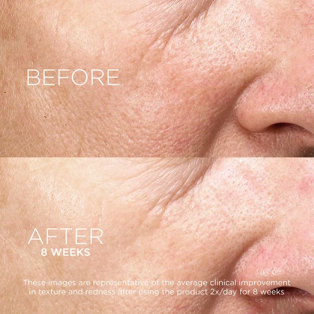 Before and After