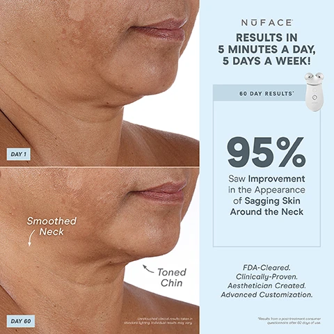 Image 1, day 1 vs day 60, smoothed neck and toned chin. unretouched clinical results taken in standard lighting - individual results may vary. results in 5 minutes a day, 5 days a week. 60 day results - 95% saw improvement in the appearance of sagging skin around the neck. FDA cleared, clinically proven, aesthetician created, advanced customization. results from a post treatment consumer questionnaire after 60 days of use. image 2, 1 device, 3 attachments, endless treatments. built in skin sensor - ensures consistent microcurrent intensity for all skin types. boost button - for +25% microcurrent power. smart device technology - perfect for advanced customization. facial trainer attachment - tones, lift and contours neck, cheek and forehead. additional attachments sold separately. energizing hum - gentle vibration when device is turned on. 3 intensity levels. unlock exclusive treatments - bluetooth enabled to pair with the NuFACE smart app. FDA cleared, clinically proven, aesthetician created. image 3, 1 device endless results. smooth the neck, contour the cheeks, lift the brow. image 4, before and after, lifted hooded eyelid and brow, lifted jaw.  unretouched clinical results taken in standard lighting, individual results may vary. instant results in 5 minutes. immediate results - 90% saw a lifted appearance. FDA cleared, clinically proven, aesthetician created, advanced customisation. image 4, day 1 vs day 60 - reduced deep lines. unretouched clinical results take in standard lightening, individual results may vary. results in 5 minutes, 5 days a week. 60 day results, 93% saw reduction in the appearance of deep lines. FDA cleared, clinically proven, aesthetician created, advanced customisation. results from post treatment consumer questionnaire after 60 days of use. image 5, 1 device, endless customisable results. instant results that build with consistent use. contour - cheeks. lift - eyes and brows. tone - jowls and jawline. smooth - neck and forehead. lift - lips and smile lines. with effect lip and eye attachment. image 6, 1 device, endless customisable results. instant results that build with consistent use. contour - cheeks. lift - eyes and brows. tone - jowls and jawline. smooth - neck and forehead. lift - lips and smile lines. image 7, microcurrent 101. a low level electrical current that mimics and re-energises the body's natural current to tone, lift and contour down to the muscles. skincare is your nutrition. microcurrent is your fitness. trinity+ is fitness for your face. image 8, unlock app exclusive treatments to target different layers of skin and muscles. help reduce wrinkles and pump skin with skin tightening mode - epidermis. helps instantly lift and contour with instant lift mode - hypodermis. long term muscle sculpting with pro toning mode - muscle. after 15 minutes of use, after 14 days of use. unlocked with the nuface app. image 9, smart app. follow step by step tutorials, track progress. customise results with app exclusive treatments. set treatment reminders. image 10, comparison of three nuface devices. trinity+ advanced customisation. unlock app exclusive treatments - yes. boost with 25% microcurrent - yes. nuface smart app - yes. attachment options (eye and lip attachment and LEF red light attachment sold separately - yes. microcurrent treatment areas - jowls and jawline, neck, cheeks and forehead, around eyes and brows, around mouth and lips, smile lines. mini+ on the go lifting. unlock app exclusive treatments - yes. boost with 25% microcurrent - no. nuface smart app - yes. attachment options (eye and lip attachment and LED red light attachment sold separately - no. microcurrent treatment areas - jowls and jawline, neck, cheeks and forehead. fix, instant finisher.